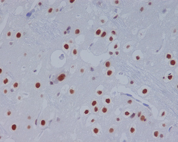 2 - Anti-STAT3 Rabbit Monoclonal Antibody ABO13616