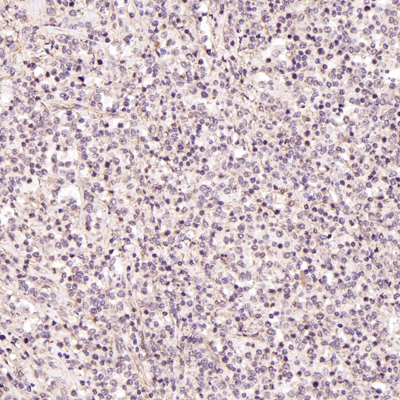 2 - Anti-STAT3 Rabbit Monoclonal Antibody ABO13616