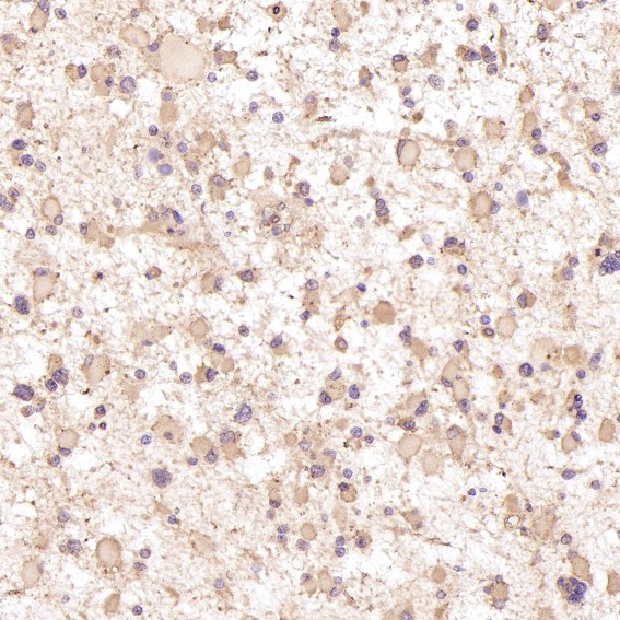 2 - Anti-STAT3 Rabbit Monoclonal Antibody ABO13616