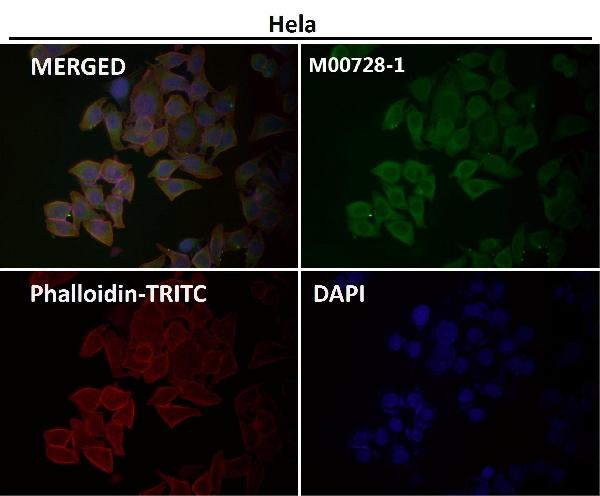 1 - Anti-Smad1 Rabbit Monoclonal Antibody ABO13617