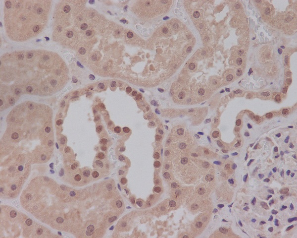 2 - Anti-Smad1 Rabbit Monoclonal Antibody ABO13617