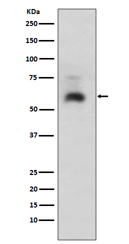1 - Anti-Smad1 Rabbit Monoclonal Antibody ABO13617