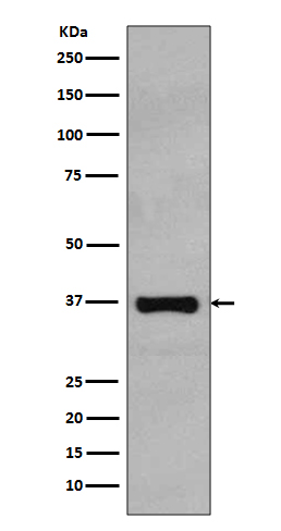 1 - Anti-Rad51 Rabbit Monoclonal Antibody ABO13618