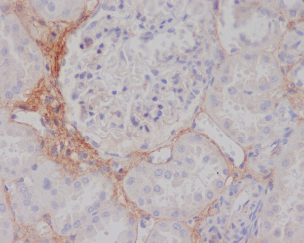 2 - Anti-TGFBI/Beta Ig H3 Rabbit Monoclonal Antibody ABO13620