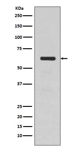 1 - Anti-TGFBI/Beta Ig H3 Rabbit Monoclonal Antibody ABO13620