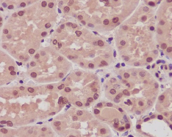 2 - Anti-ARRB1/Beta Arrestin 1 Rabbit Monoclonal Antibody ABO13622