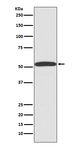 1 - Anti-ARRB1/Beta Arrestin 1 Rabbit Monoclonal Antibody ABO13622