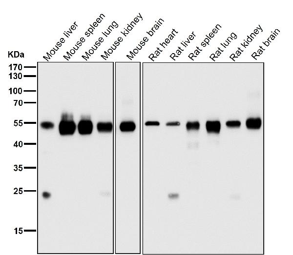 1 - Anti-ARRB1/Beta Arrestin 1 Rabbit Monoclonal Antibody ABO13622