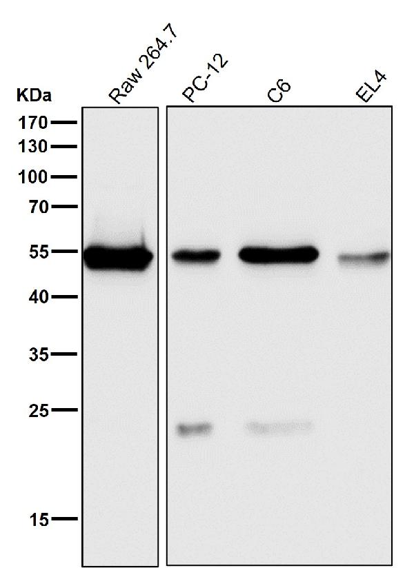 1 - Anti-ARRB1/Beta Arrestin 1 Rabbit Monoclonal Antibody ABO13622
