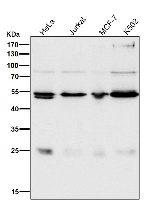 1 - Anti-ARRB1/Beta Arrestin 1 Rabbit Monoclonal Antibody ABO13622
