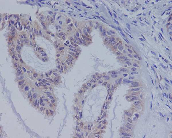 2 - Anti-B Raf Rabbit Monoclonal Antibody ABO13623