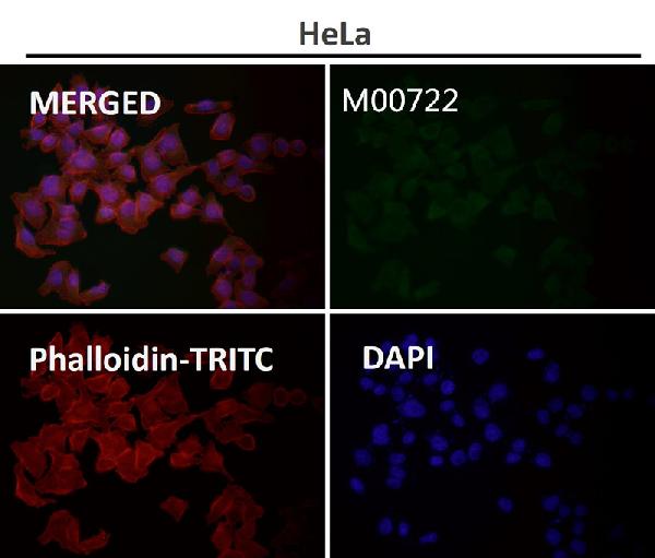 1 - Anti-ROCK1 Rabbit Monoclonal Antibody ABO13624