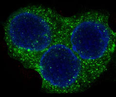 3 - Anti-ROCK1 Rabbit Monoclonal Antibody ABO13624