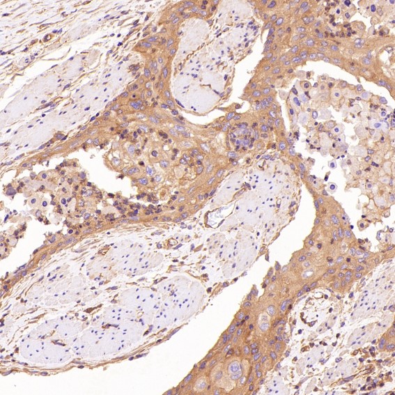 2 - Anti-ROCK1 Rabbit Monoclonal Antibody ABO13624
