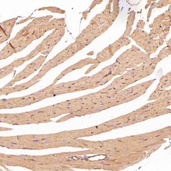 2 - Anti-ROCK1 Rabbit Monoclonal Antibody ABO13624