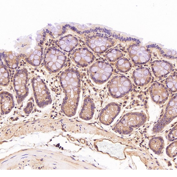 2 - Anti-ROCK1 Rabbit Monoclonal Antibody ABO13624
