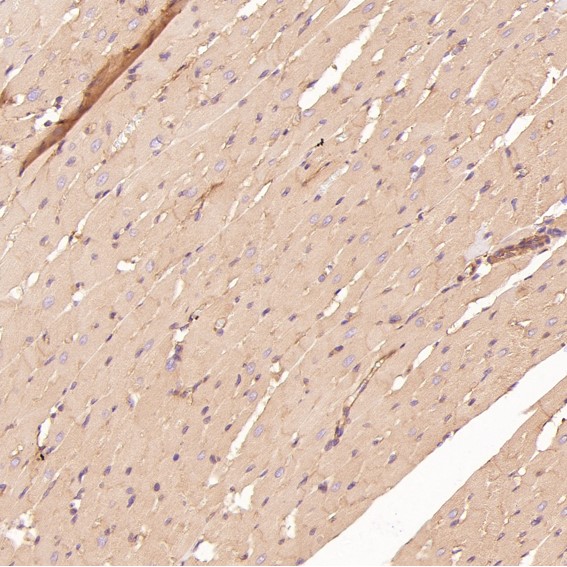 2 - Anti-ROCK1 Rabbit Monoclonal Antibody ABO13624