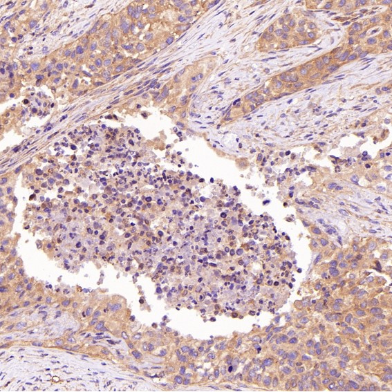 2 - Anti-ROCK1 Rabbit Monoclonal Antibody ABO13624