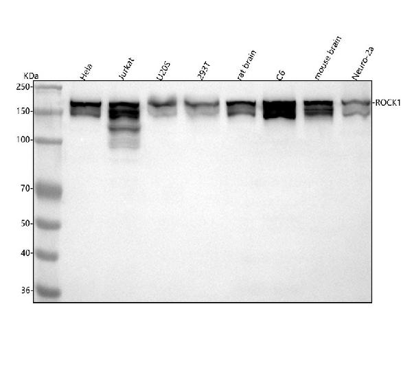 1 - Anti-ROCK1 Rabbit Monoclonal Antibody ABO13624