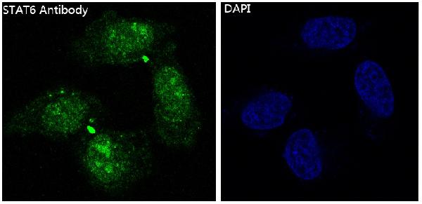 3 - Anti-STAT6 Rabbit Monoclonal Antibody ABO13625