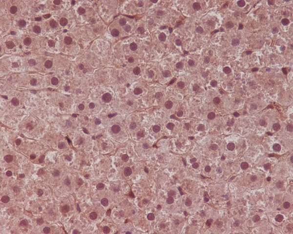 2 - Anti-STAT6 Rabbit Monoclonal Antibody ABO13625