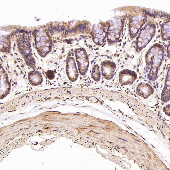 2 - Anti-STAT6 Rabbit Monoclonal Antibody ABO13625