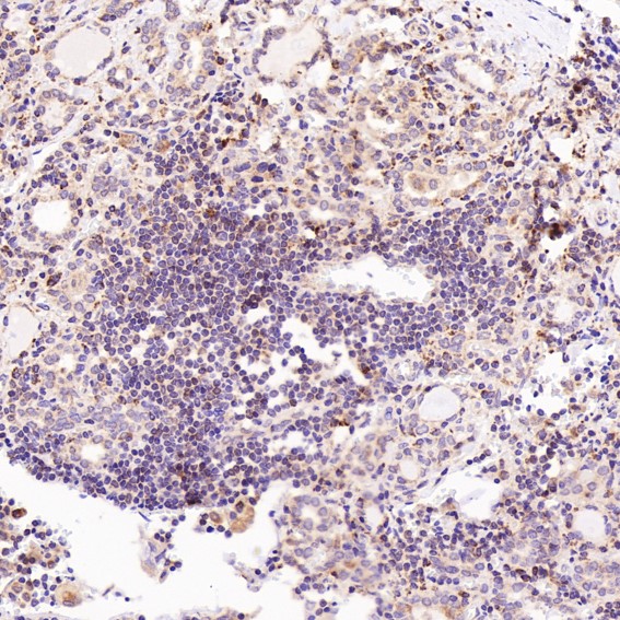 2 - Anti-STAT6 Rabbit Monoclonal Antibody ABO13625