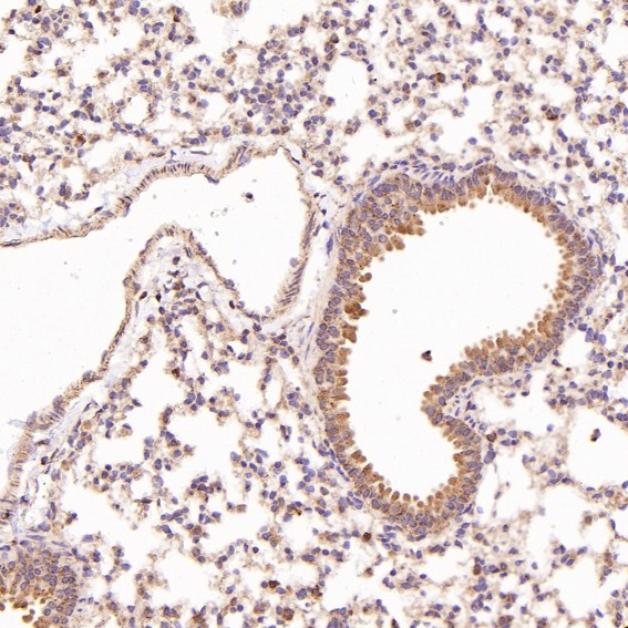 2 - Anti-STAT6 Rabbit Monoclonal Antibody ABO13625