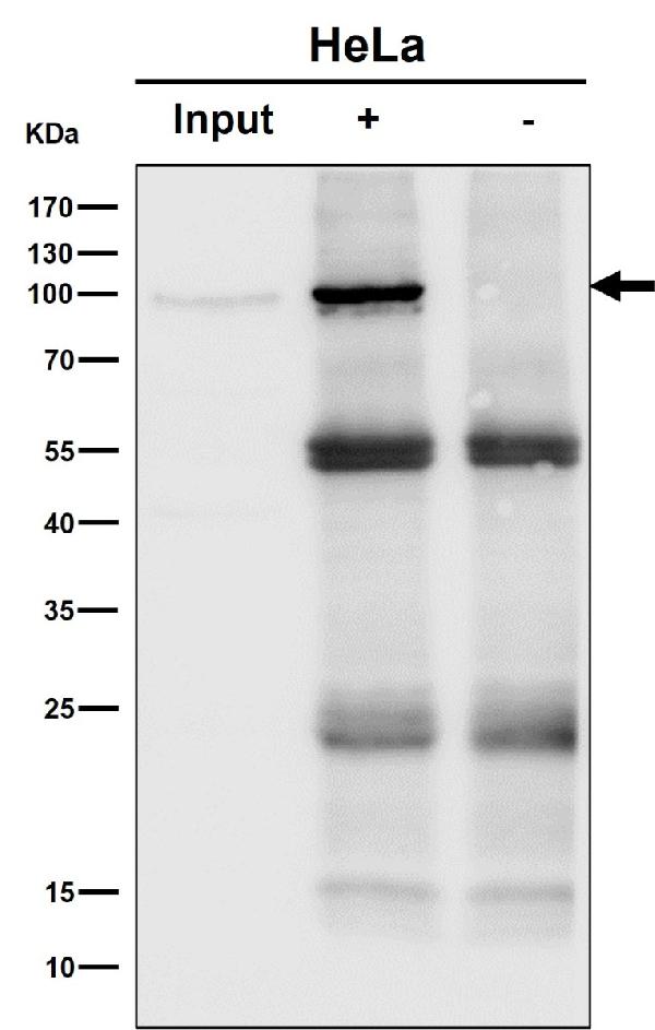 1 - Anti-STAT6 Rabbit Monoclonal Antibody ABO13625