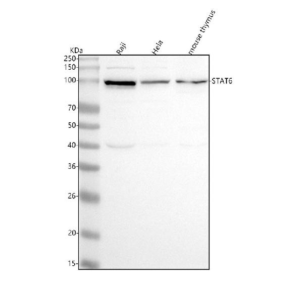1 - Anti-STAT6 Rabbit Monoclonal Antibody ABO13625