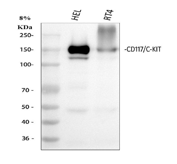 1 - Anti-c-Kit Rabbit Monoclonal Antibody ABO13626