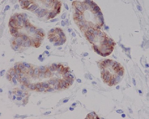 2 - Anti-c-Kit Rabbit Monoclonal Antibody ABO13626