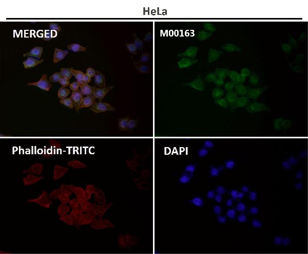 1 - Anti-GLUT1 SLC2A1 Rabbit Monoclonal Antibody ABO13627