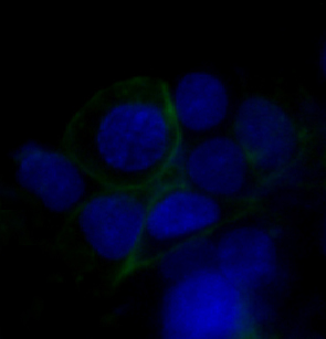 3 - Anti-GLUT1 SLC2A1 Rabbit Monoclonal Antibody ABO13627