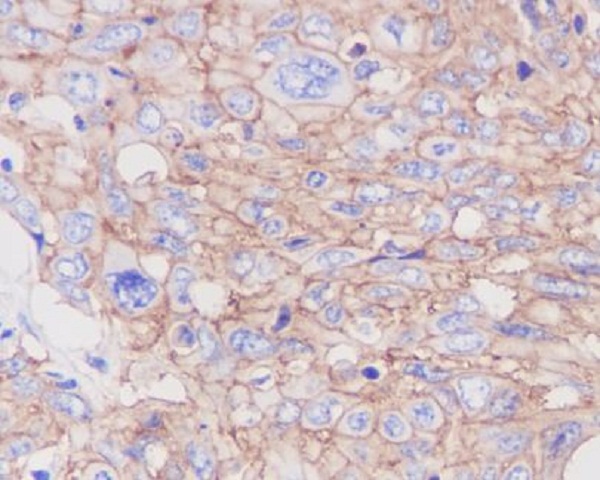 2 - Anti-GLUT1 SLC2A1 Rabbit Monoclonal Antibody ABO13627