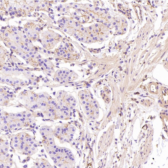 2 - Anti-GLUT1 SLC2A1 Rabbit Monoclonal Antibody ABO13627