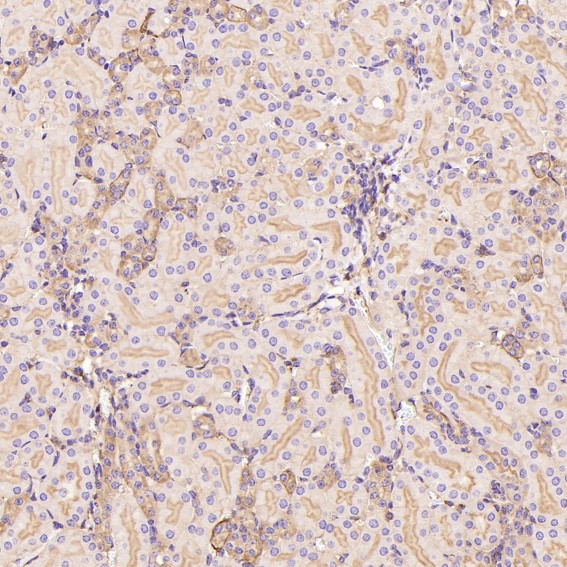 2 - Anti-GLUT1 SLC2A1 Rabbit Monoclonal Antibody ABO13627