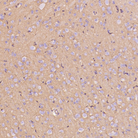 2 - Anti-GLUT1 SLC2A1 Rabbit Monoclonal Antibody ABO13627