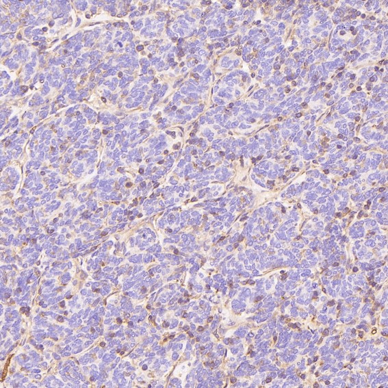 2 - Anti-GLUT1 SLC2A1 Rabbit Monoclonal Antibody ABO13627