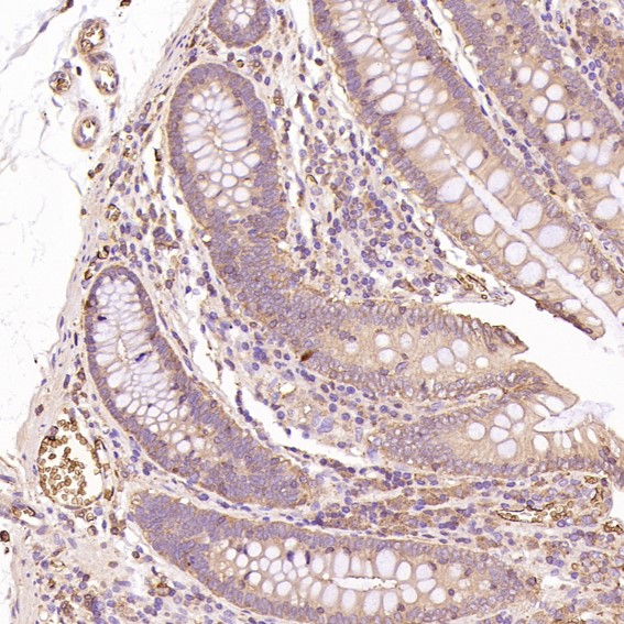 2 - Anti-GLUT1 SLC2A1 Rabbit Monoclonal Antibody ABO13627