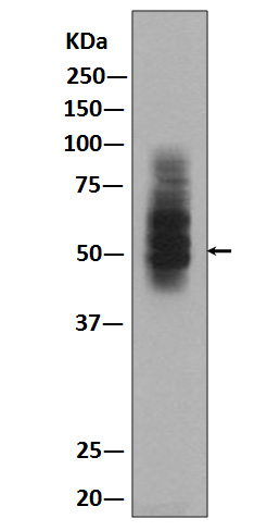 1 - Anti-GLUT1 SLC2A1 Rabbit Monoclonal Antibody ABO13627