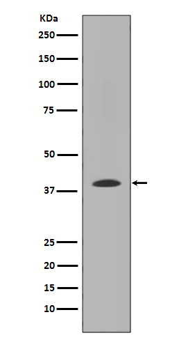 1 - Anti-MMP12 Rabbit Monoclonal Antibody ABO13628