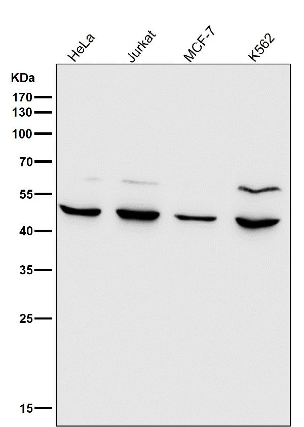 1 - Anti-MMP12 Rabbit Monoclonal Antibody ABO13628