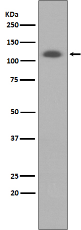 1 - Anti-ABCG1 Rabbit Monoclonal Antibody ABO13629