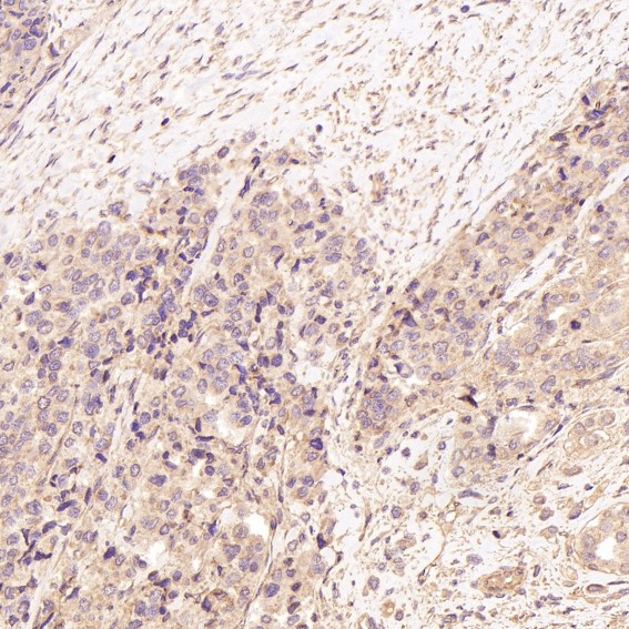 2 - Anti-EpCAM/Trop1 Rabbit Monoclonal Antibody ABO13630