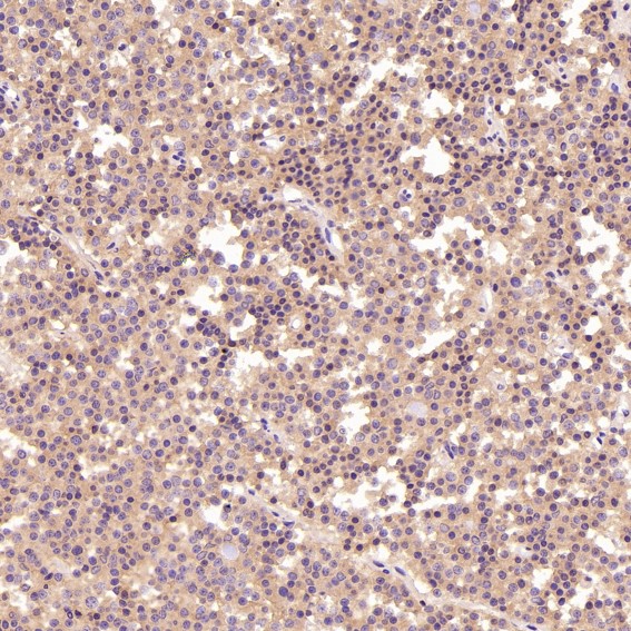 2 - Anti-EpCAM/Trop1 Rabbit Monoclonal Antibody ABO13630