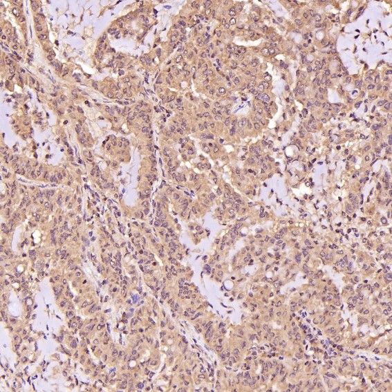 2 - Anti-EpCAM/Trop1 Rabbit Monoclonal Antibody ABO13630