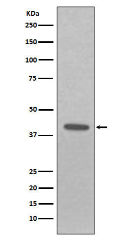 1 - Anti-EpCAM/Trop1 Rabbit Monoclonal Antibody ABO13630
