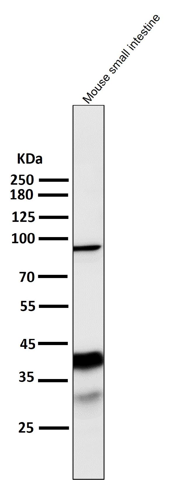 1 - Anti-EpCAM/Trop1 Rabbit Monoclonal Antibody ABO13630