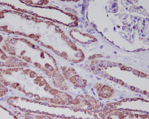 2 - Anti-Hsp60 HSPD1 Rabbit Monoclonal Antibody ABO13632